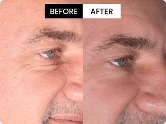 Robert before and after result