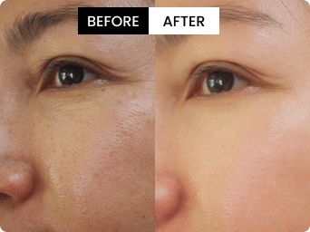 Jade before and after result