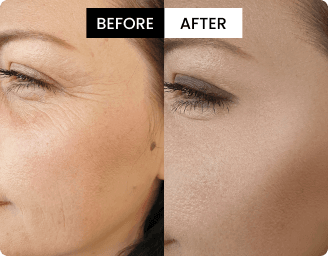 Ella before and after result
