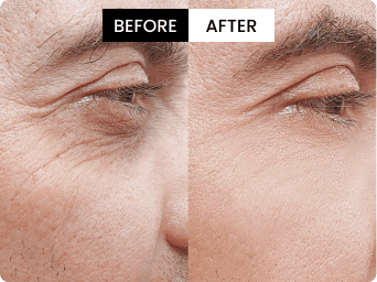 Stephen before and after result