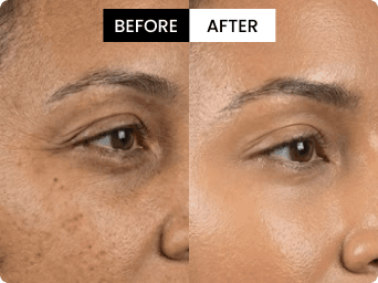 Emily before and after result